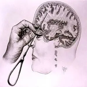 lobotomy sound effects